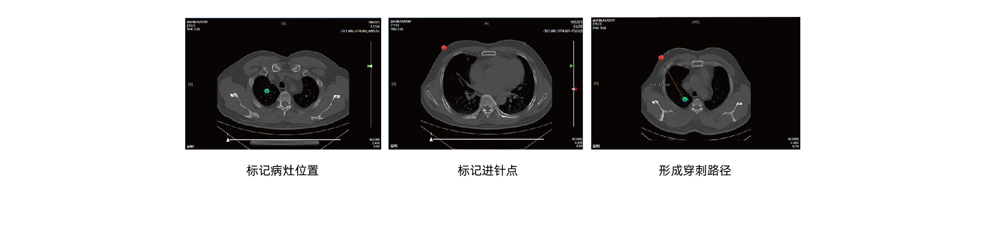 (影像介入)CT介入手术移动工作站_05.jpg